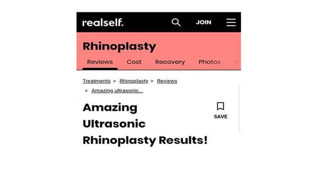 amazing ultrasonic rhinoplasty results